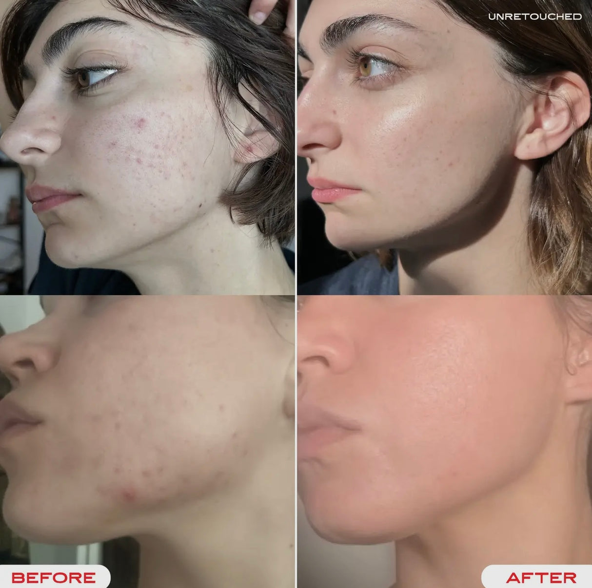 Tallow Face Balm | Tallow Skin Care Face Moisturizer