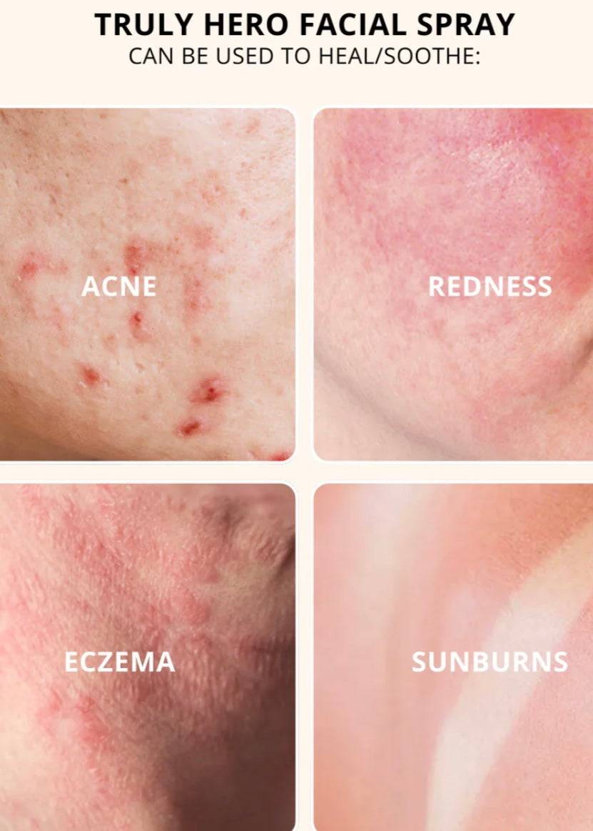 Truly Hero Facial Spray