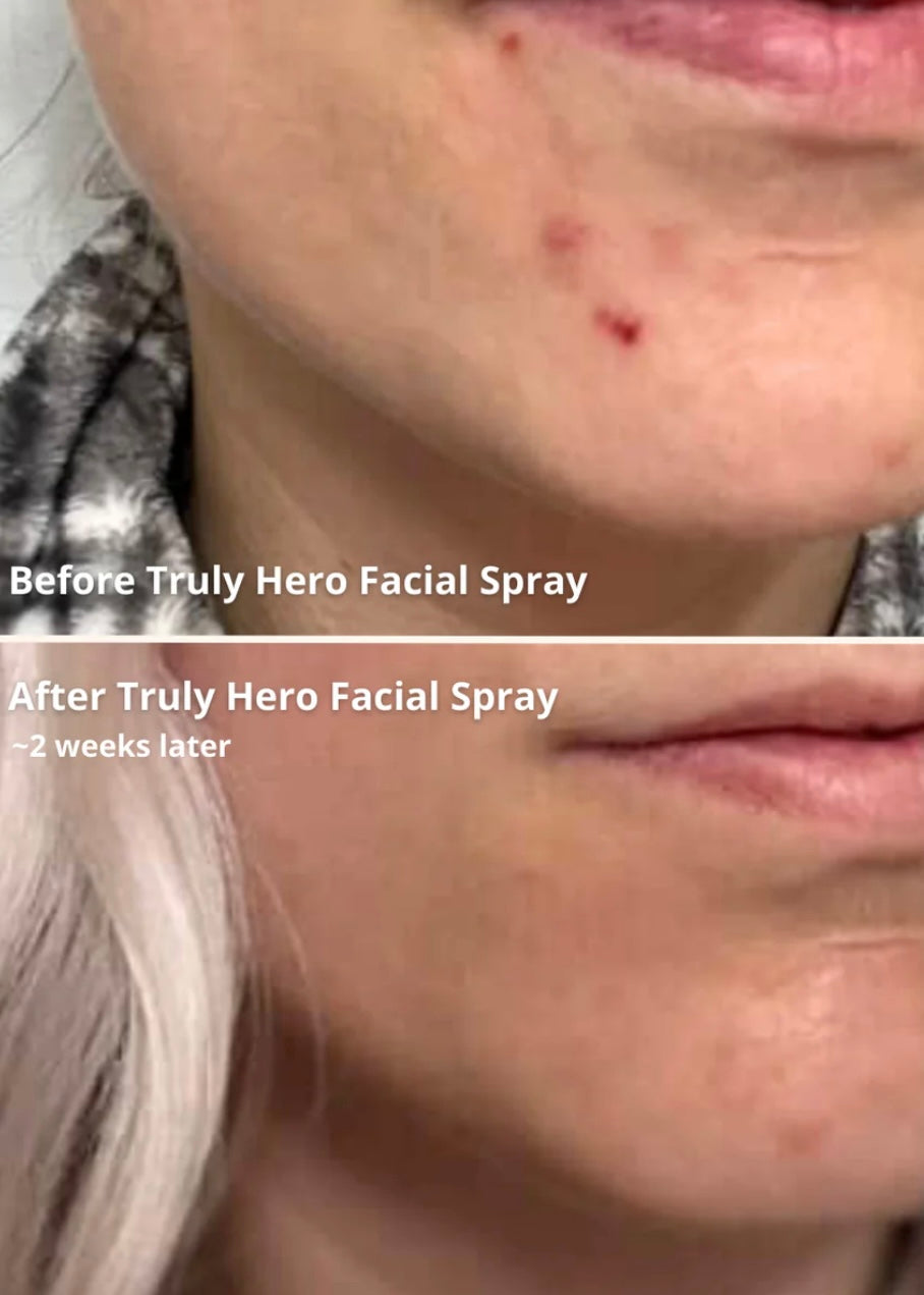 Truly Hero Facial Spray