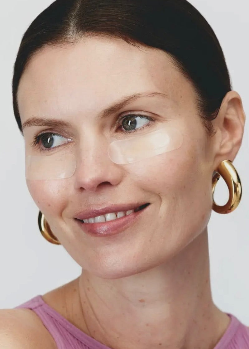 Self-Dissolving Microneedle Patches