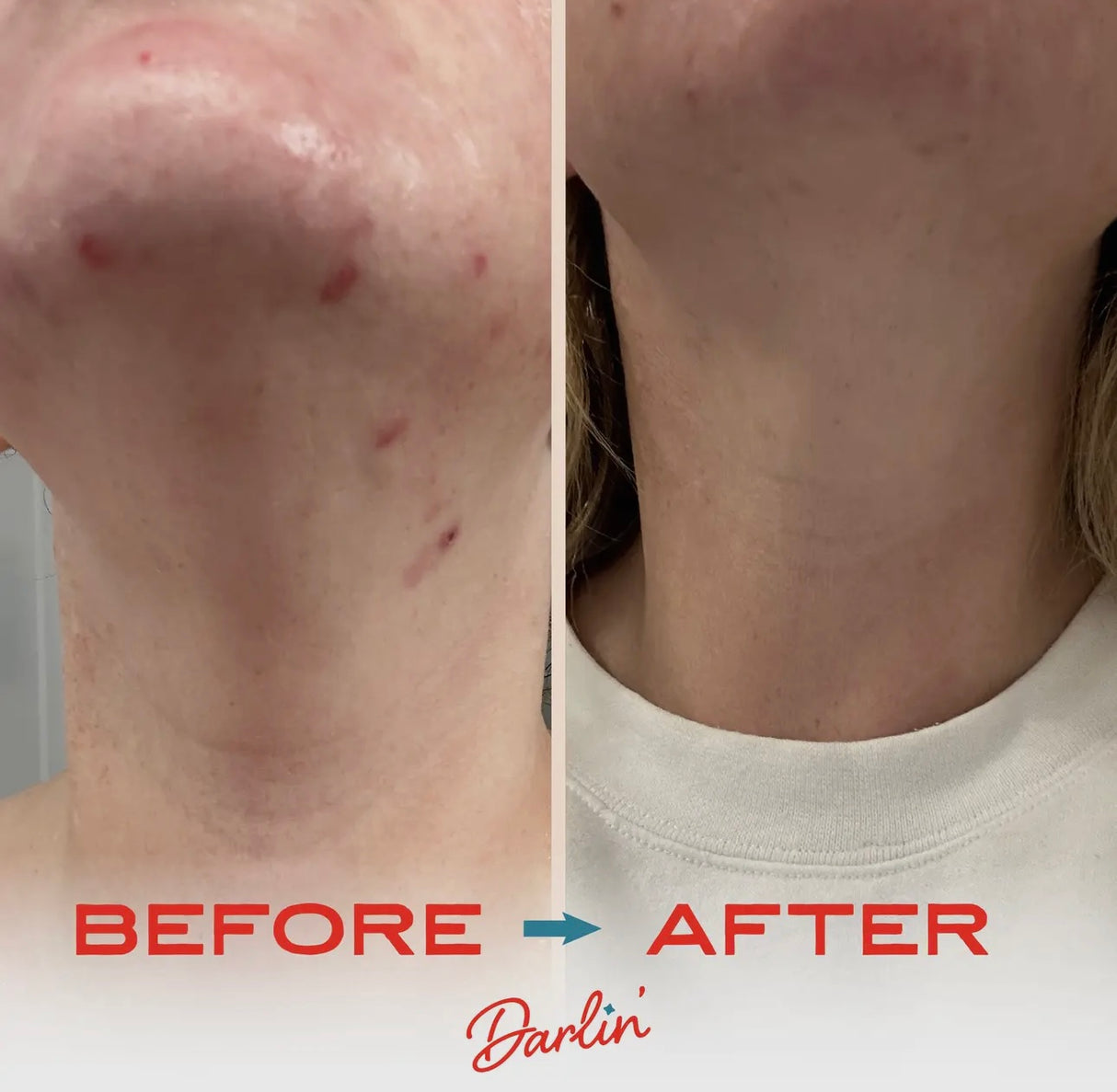 Tallow Face Balm | Tallow Skin Care Face Moisturizer