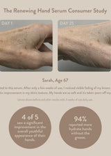 Renewing Hand Serum