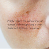 10% Azelaic Acid Redness Calming Cream