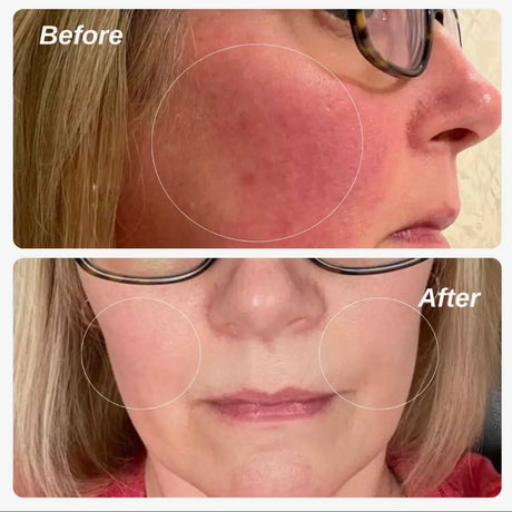 Redness Control Moisturizer | 50mL