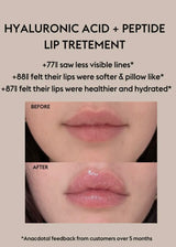 Hyaluronic Acid + Peptide Lip Treatment