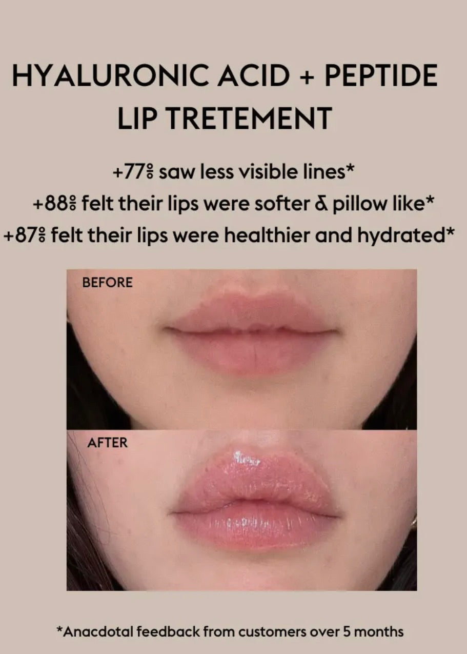 Hyaluronic Acid + Peptide Lip Treatment