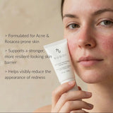 10% Azelaic Acid Redness Calming Cream