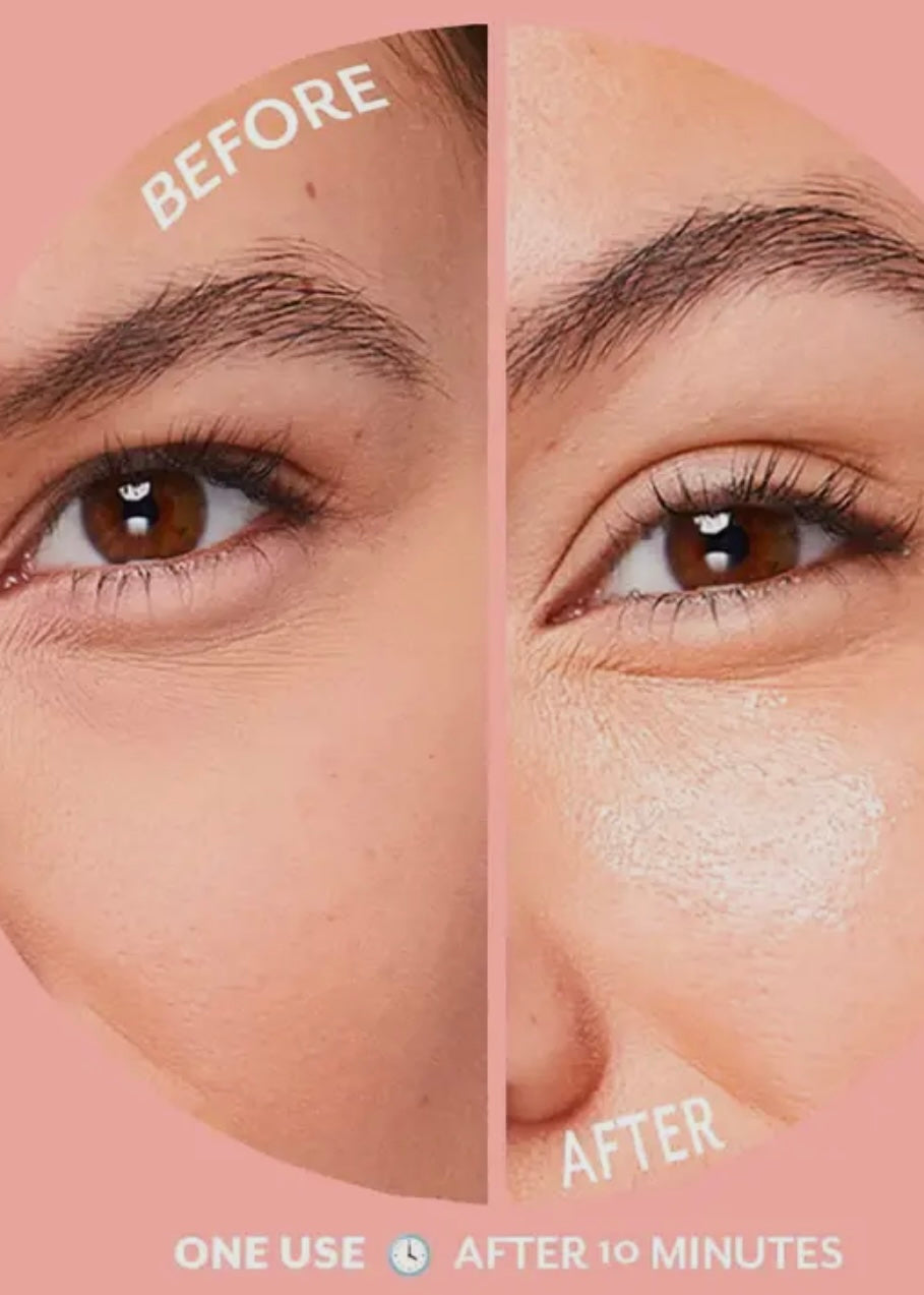 Under Eye Bubbly Eye Gels Patches with Niacinamide