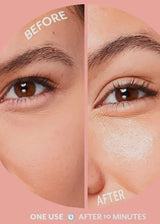 Under Eye Bubbly Eye Gels Patches with Niacinamide