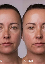 Face Polishing Peel Pads