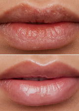 Lip Rehab Serum Oil