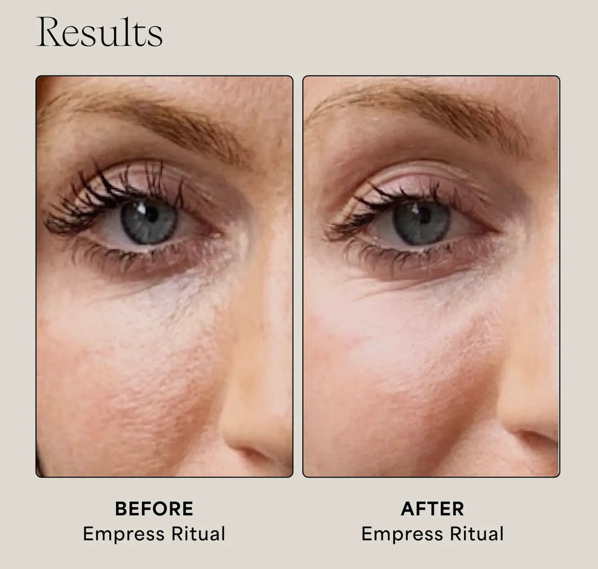 Empress Hydrasoothe Face Mist