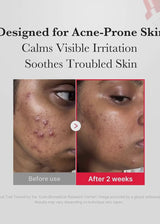 Medicube Hypochlorous Acid Daily Facial Spray