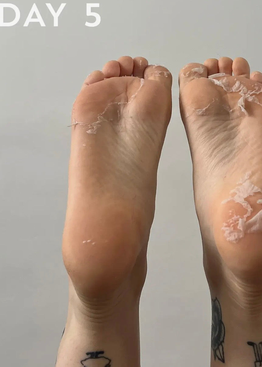 +maskology Foot Peel Professional Foot Treatment