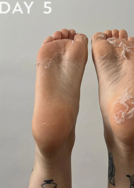 +maskology Foot Peel Professional Foot Treatment
